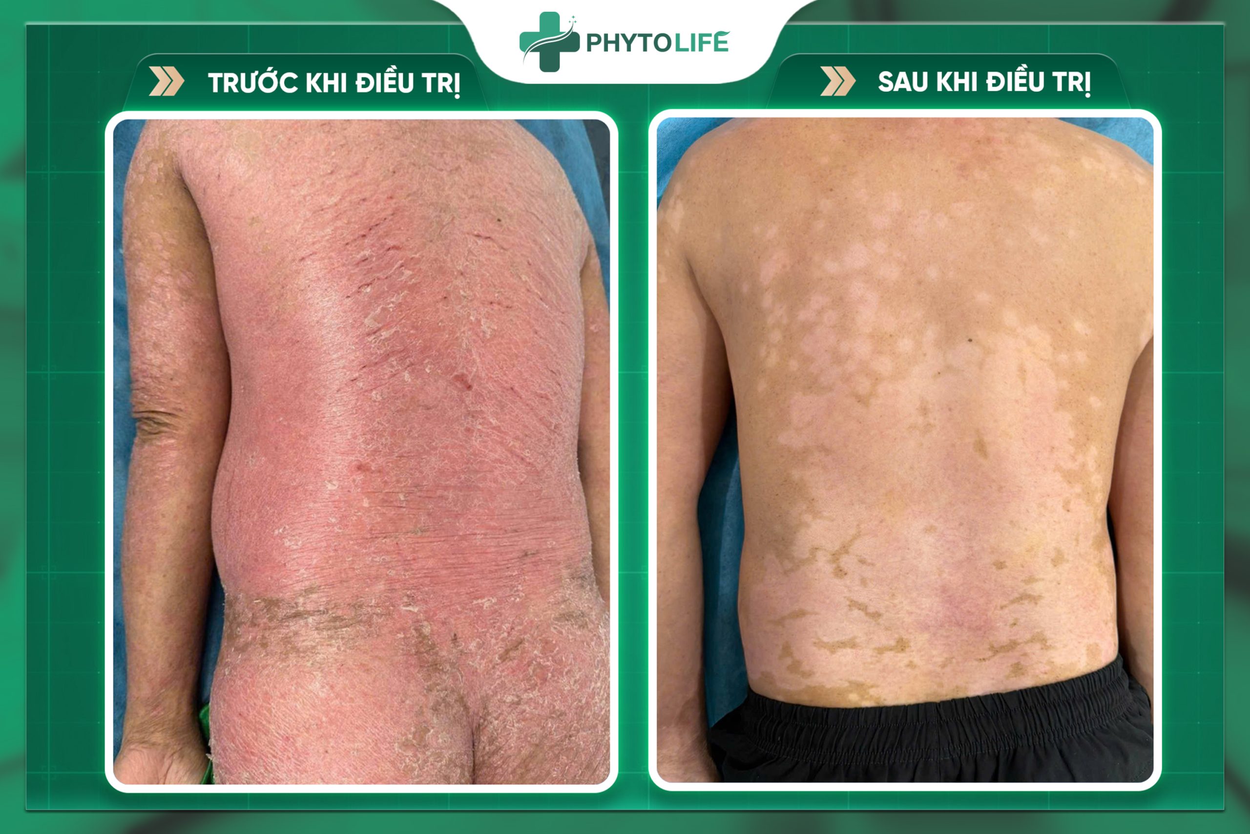 Hiệu quả điều trị 2